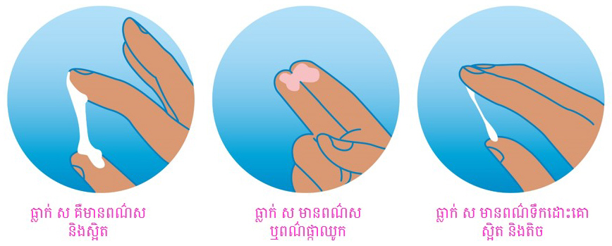 តើធ្លាក់ ស ឬ ការហូទឹករំអិល គឺជាអ្វី?